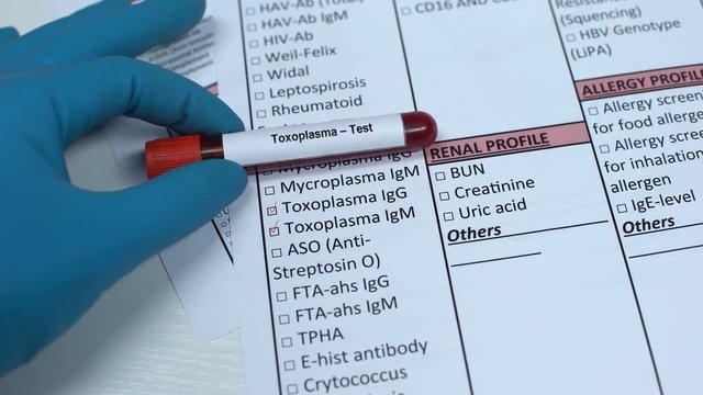 Toxoplasma, doctor checking disease in lab blank, showing blood sample in tube