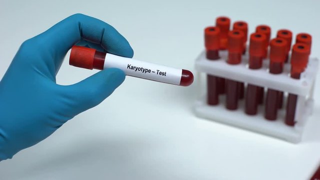 Karyotype, doctor showing blood sample in tube, lab research, health check-up