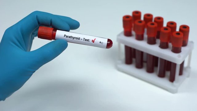 Negative parathyroid test, doctor showing blood sample, lab research, healthcare