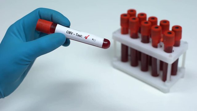 Negative CMV test, doctor showing blood sample, lab research, health check-up