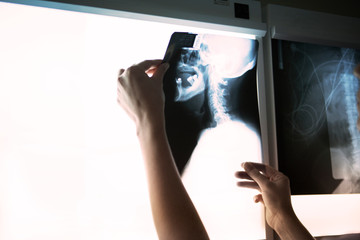 Doctor looking at x-ray image
