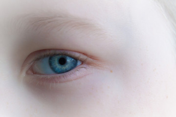 Baby blue beautiful, brooding eyes of a boy