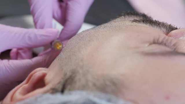 contour plastics for men