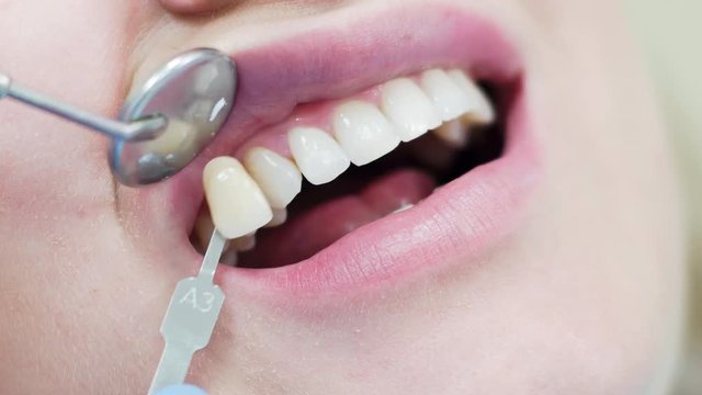 Oral hygiene, dental care. Dentist compares the color of teeth