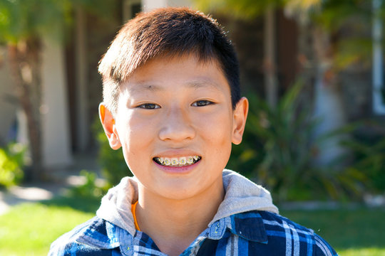 Portrait of young Asian boy with tooth braces. Young teen boy smiling and showing his orthodontic braces on his teeth.