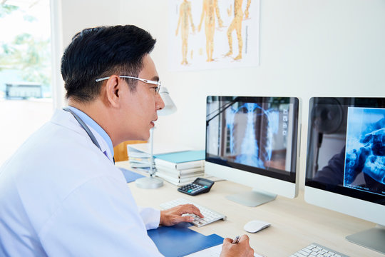 Mature doctor examining x-ray image