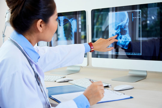 Female doctor examining x-ray image