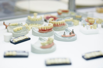 Obraz na płótnie Canvas Dental orthodontic tools. device for making a molded tooth, dental prosthetics. Molding teeth.