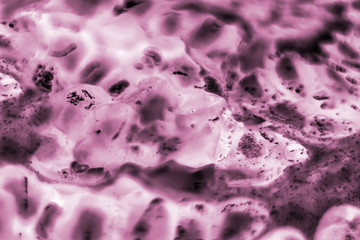 cells of the human body. tissues affected by cancer cells under the microscope,  Cancer drugs....