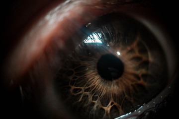 eye
