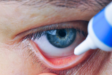 Instill eyedrops or ointment on eye.