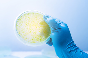 Colony of blue green algae in culture medium plate.