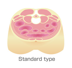 Type of obesity illustration . Abdominal sectional View . Healthy body/ Standard type.