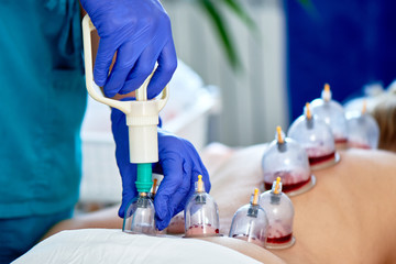 Healing bloodletting, hijama or phlebotomy. Hajam master conducts cupping therapy on a young woman....