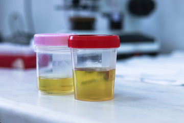 Urine samples in special tubes for examination. On the background of tubes with blood samples in the clinical laboratory