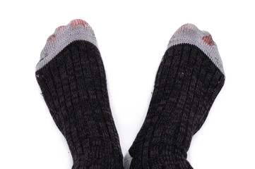 Löchrige Socken als Konzept für Armut (isoliert über weißem Hintergrund)