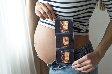 Pregnant woman holding ultrasound image.