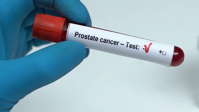 Prostate cancer, doctor holding blood sample in tube close-up, health check-up