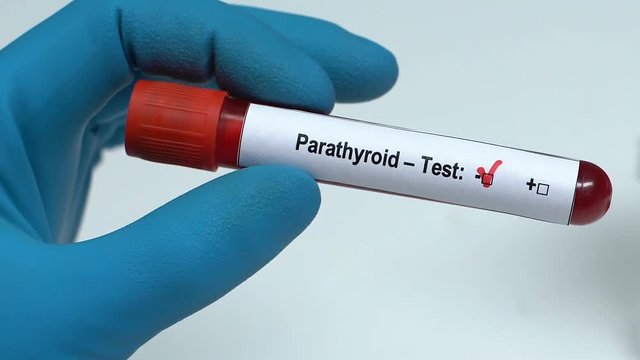 Parathyroid, doctor holding blood sample in tube close-up, health check-up
