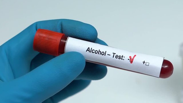 Alcohol-test, doctor holding blood sample in tube close-up, health check-up