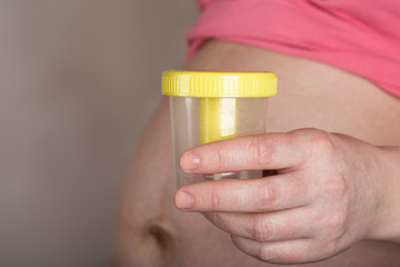 Young pregnant woman keeps empty urine container close to her belly.