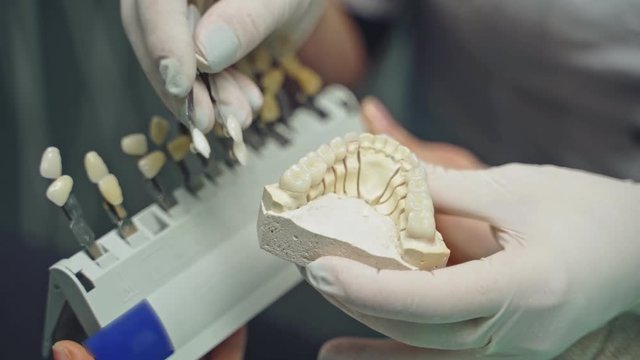 A doctor in latex gloves is holding in his hand an cast of the jaw with teeth and selecting crowns with a similar shape on the blurred background. Close-up.