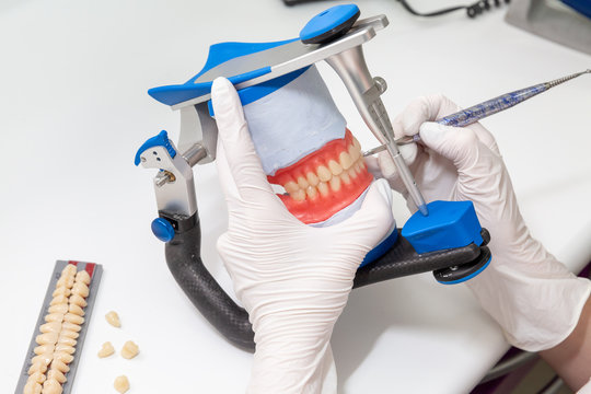 dental crowns in the manufacturing process in the hands