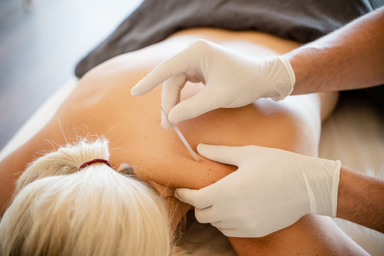 Fisioterapia manos punci&oacute;n seca clinica