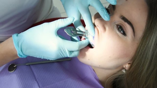 The dentist makes a cast of teeth for prosthetics from a special plastic mass of white and blue. orthopedic dentistry