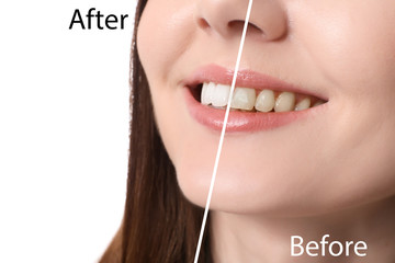 Beautiful young woman with healthy teeth on white background