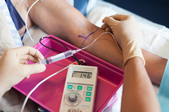 Anesth&eacute;sie coco-r&eacute;gionale