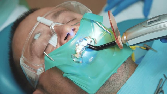 View of dental curing light using for teeth treatment
