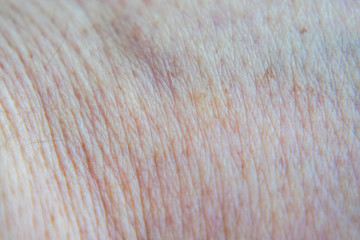 The texture of human skin men
