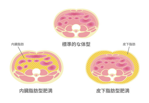 617 Best 内臓脂肪 Images Stock Photos Vectors Adobe Stock