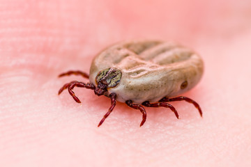 Encephalitis Virus or Lyme Borreliosis Disease Infectious Dermacentor Tick Arachnid Parasite Insect on Skin Macro