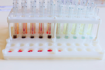 Medical equipment. Blood test