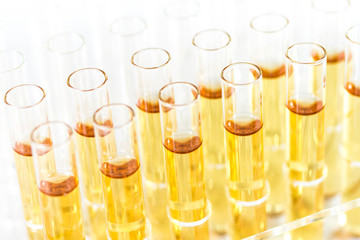 Reagenzgl&auml;ser mit Fl&uuml;ssigkeit im Labor 