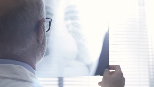 Doctor checking a patient's radiograph of rib cage