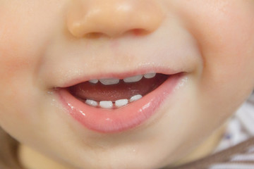 Teether erupts. Smile baby. Teeth grow.