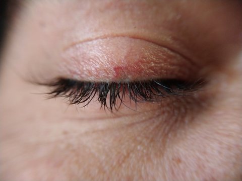 Ojo cerrado