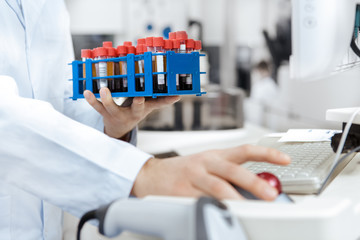 Young male scientist working with blood samples using a computer at the laboratory