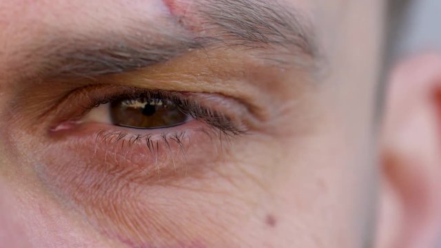 Close-up of handsome male eye is looking at the camera - the eyebrow is cut and the bruise under the eye