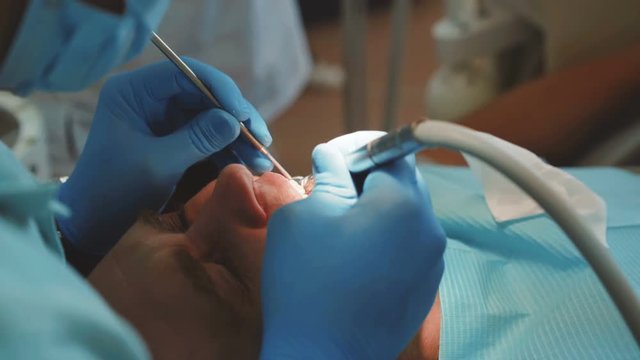 Dentist treats patient's teeth with dental drill in clinic. 4K