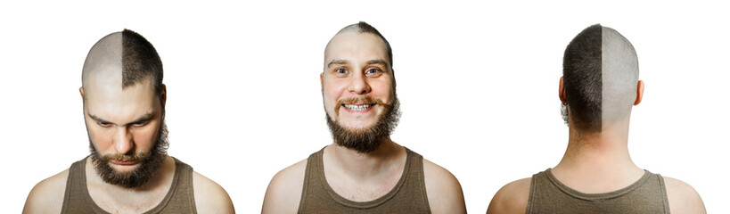 Fototapeta premium half trimmed guy: on the one hand bald, on other with hair on isolated white background. Front view, back. Concept for hairdresser, and medicine: the problem of hair loss, alopecia, transplantation