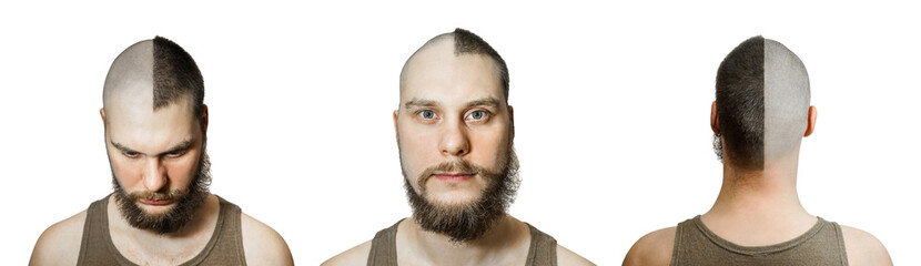 Fototapeta premium half trimmed guy: on the one hand bald, on the other with hair on isolated white background. Front view, back. Concept for hairdresser, and medicine: problem of hair loss, alopecia, transplantation