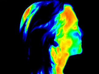 Thermographic image of the right side of the face of a woman with the photo showing different temperature in a range of colors from blue showing cold to red showing hot which can be joint inflammation - 252475008