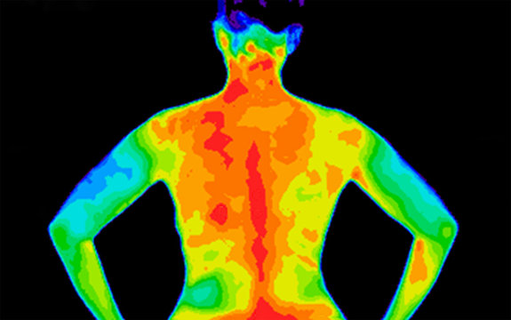 Thermographic photo of the back of the upper body of a woman with the photo showing different temperature in a range of colors from blue showing cold to red showing hot which can be joint inflammation