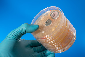 petri dish with microbe colony in doctor hand