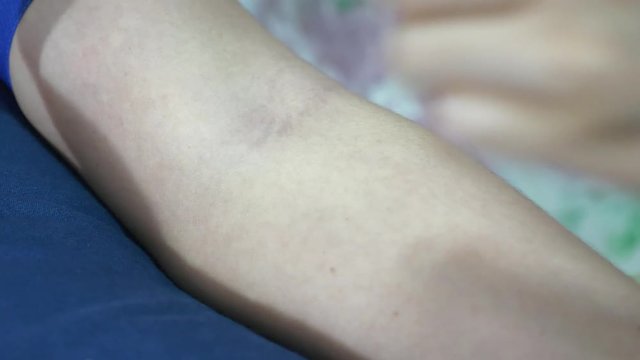doctor or nuse put needle at hand.