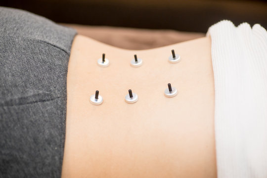 お灸をする女性